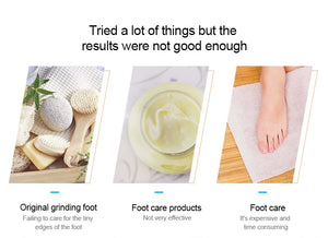 High Quality Portable Electric Callus Remover - Powerful Foot Machine for Hard & Dead Skin