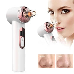 Visual Blackhead Remover with Camera - Blackhead Beauty Instrument Vacuum Cleaner