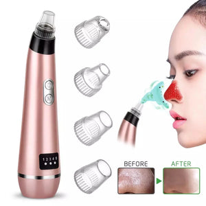 Blackhead Vacuum: LED Facial Cleansing Device