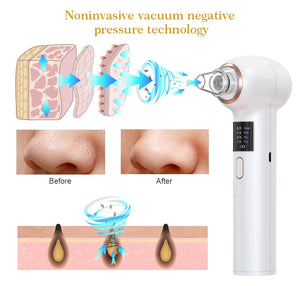 New Arrival Electric Pore Cleaner - Blackhead Remover Vacuum for Acne Removal