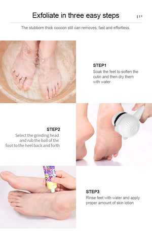 High Quality Portable Electric Callus Remover - Powerful Foot Machine for Hard & Dead Skin