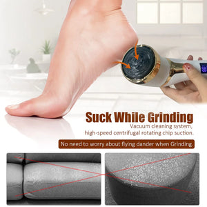 Electric Callus Remover for Feet - Portable Foot Grinder & Care Tool for Dead Skin Removal