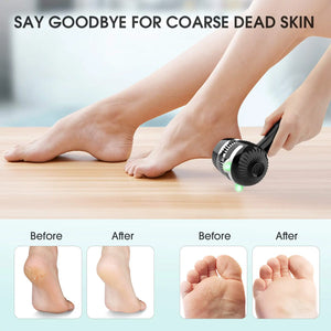 2024 Premium Callus Remover - Electric Foot Scrubber with Vacuum Adsorption for Hard Dead Skin