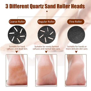 Electric Callus Remover for Feet - Portable Foot Grinder & Care Tool for Dead Skin Removal