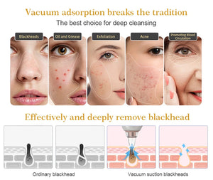 New Arrival Electric Pore Cleaner - Blackhead Remover Vacuum for Acne Removal